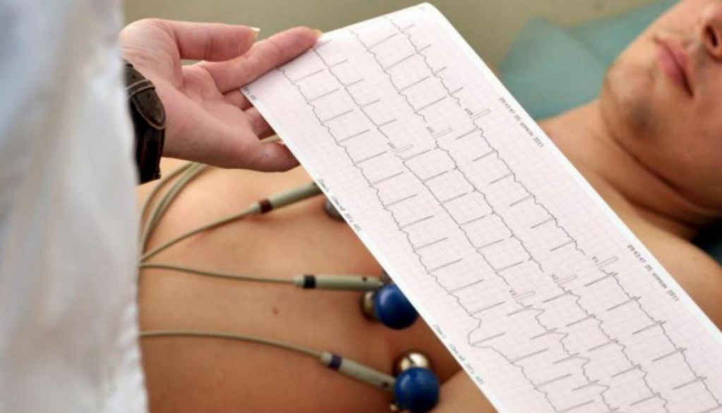 ekg